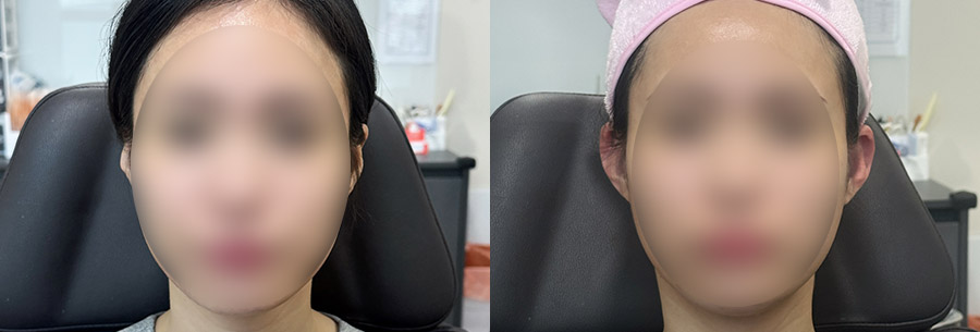 엘프귀필러