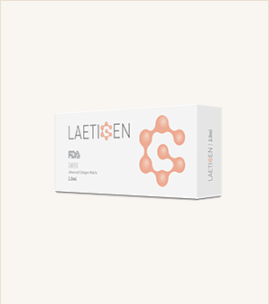 Laetigen